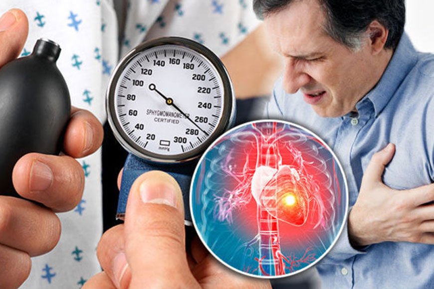 Understanding Hypertension: What You Need to Know About High Blood Pressure